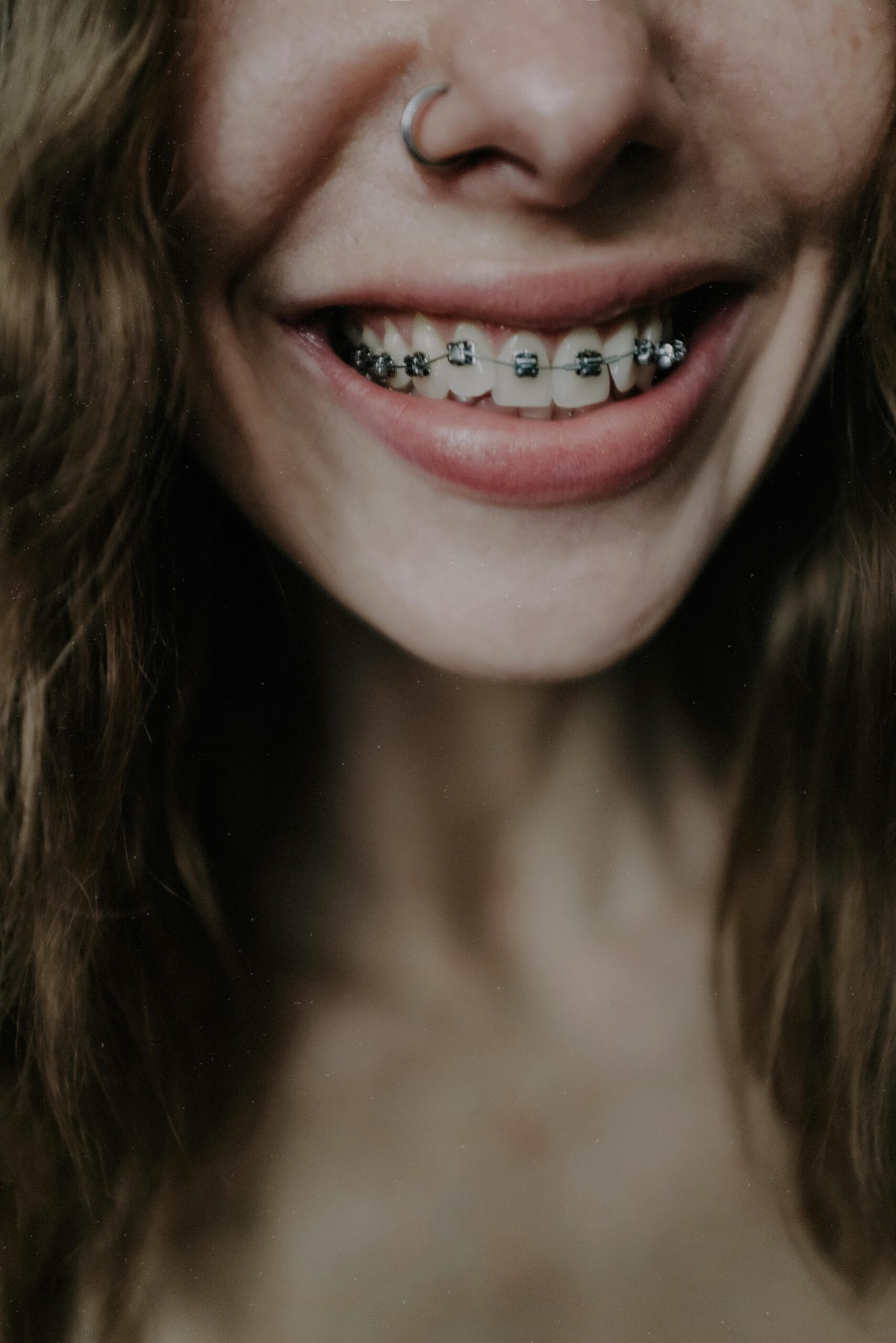Crop positive female with nose piercing smiling happily and showing upper teeth braces